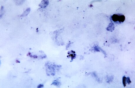 Blood cervical smear plasmodium