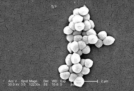 Bacteria electron electron micrograph