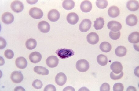Normal oval round