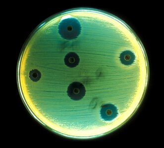 Aerobe bacteria court photo