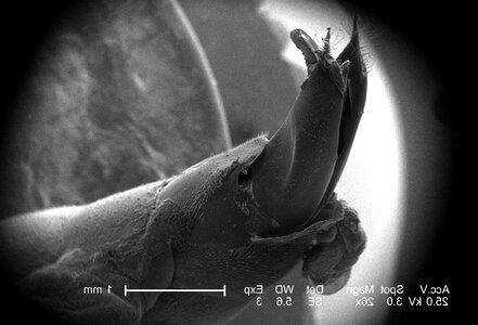 Abdominal bug little photo