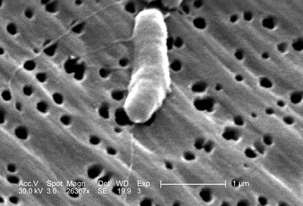 Bacteria black and white cause photo