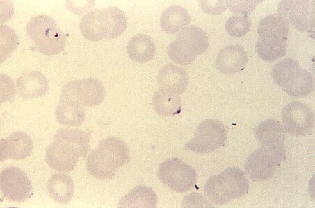 Blood cervical smear form