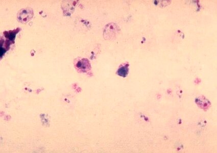 Gametocyte parasit plasmodium photo