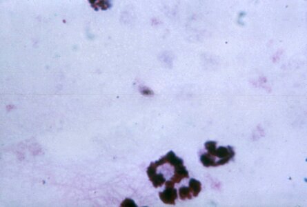 Cytoplasm film gametocyte photo