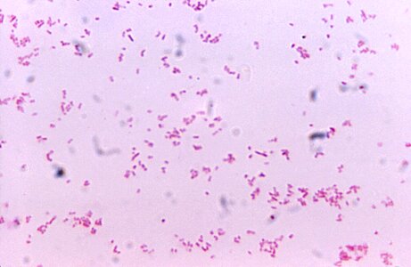 Gram negative presence