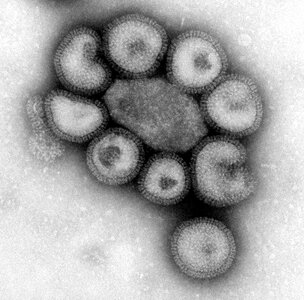 Disease influenza photo