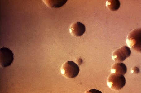 Bacteria crescent culture photo