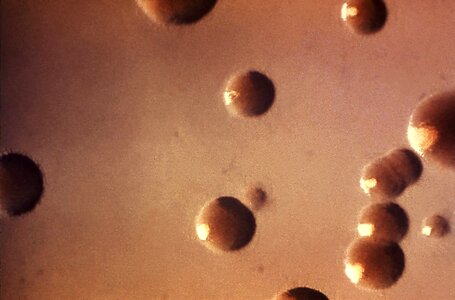 Bacteria crescent culture