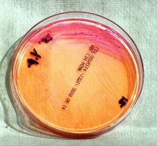 Bacteria gram negative photo