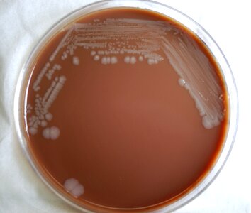 Infection  