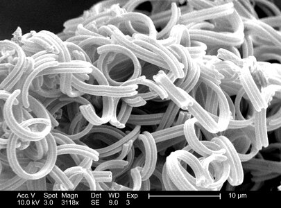 Debris morphologic 