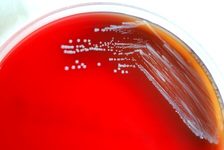 Abortus bacteria blood photo
