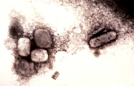 Magnification negative scrub