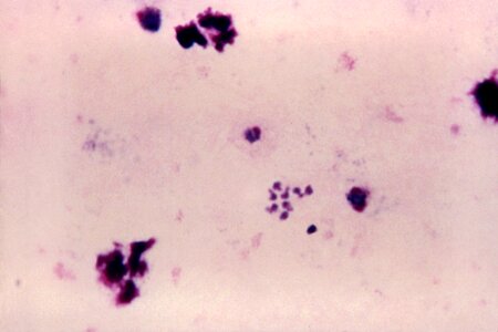 Blood cervical smear film