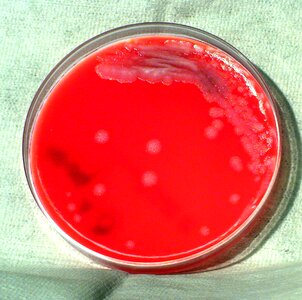 Alcohol bacillus bacteria photo