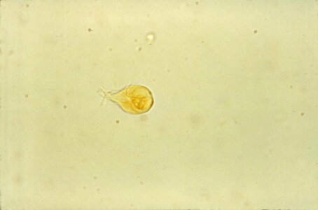 Bulb giardia intestine