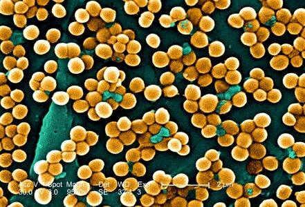 Bacteria electron methicillin