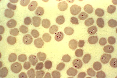 Form number plasmodium photo