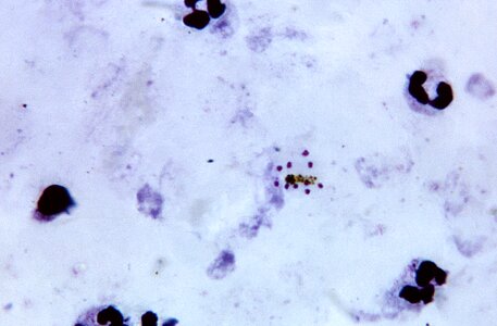 Cytoplasm faint plasmodium