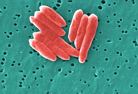 Bacteria gram grouping