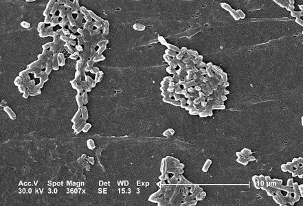 Bacteria colonial escherichia photo