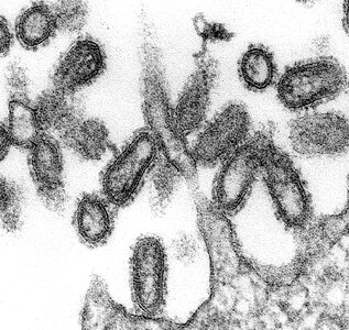 Influenza morphologic sample photo