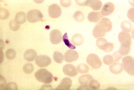 Blood cervical smear parasit photo