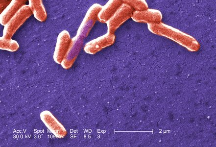 Bacteria escherichia gram photo