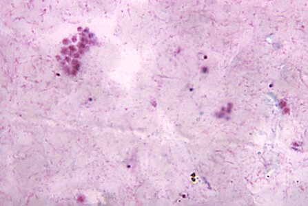 Chromatin cytoplasm debris