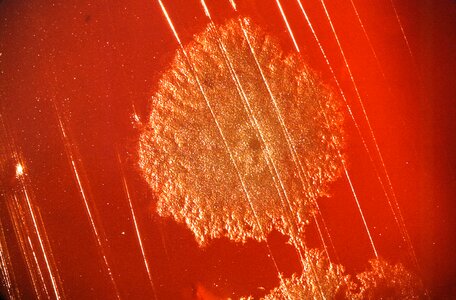 Bacteria blood colony