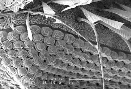 Electron electron micrograph morphologic photo