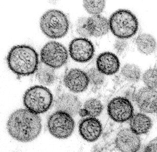 Electron electron micrograph transfer photo