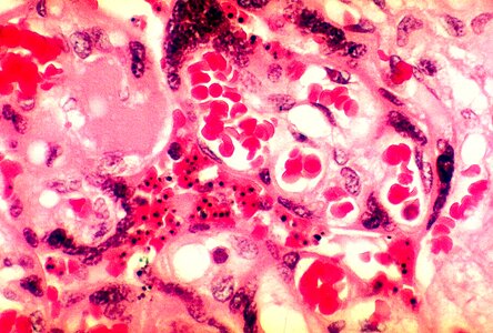 Parasit photomicrograph placenta