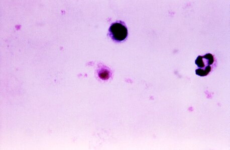 Film gametocyte plasmodium