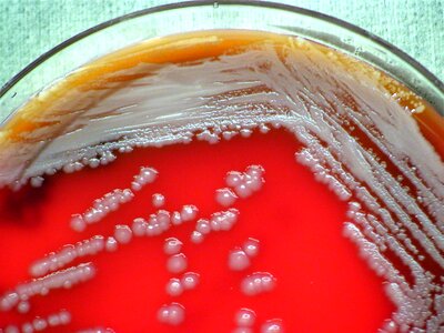 Analysis bacteria blood photo