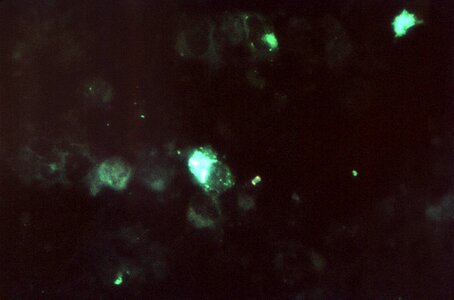 Chlamydia photomicrograph positive