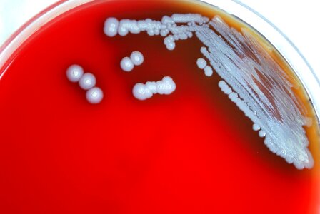 Bacteria blood blood agar