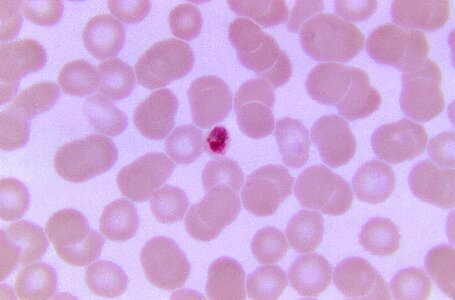 Little plasmodium scrub