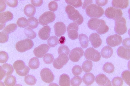 Little plasmodium scrub photo