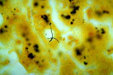 Bacteria leptospira liver photo