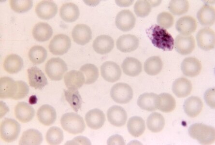 Chromatin photomicrograph rings photo