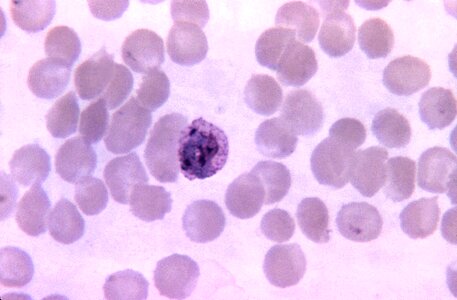 Film plasmodium 