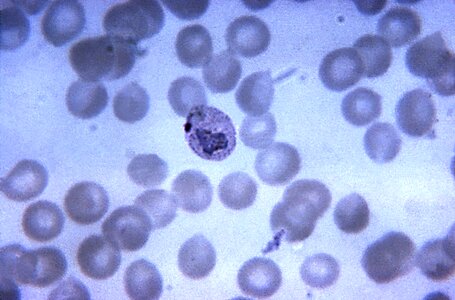 Crescent pigment trophozoite