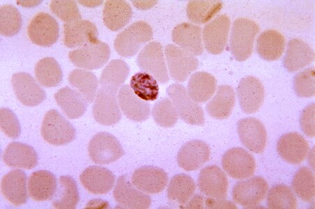 Chromatin plasmodium 