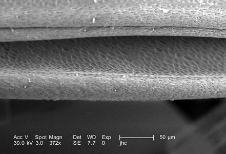 Adult antenna 