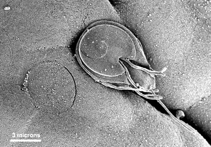 Circular injury intestine
