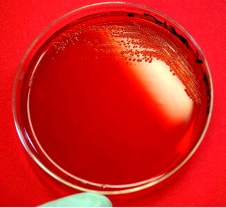 Appearance bacteria colonial
