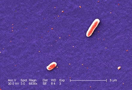 Bacteria cargo escherichia photo