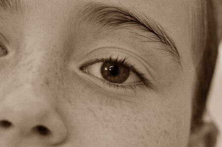 Eye freckles girl photo